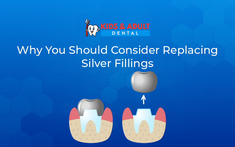 Why You Should Consider Replacing Silver Fillings