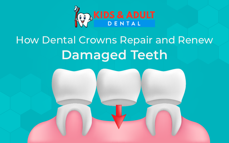 How Dental Crowns Repair and Renew Damaged Teeth