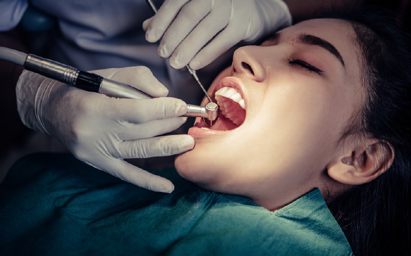 why-dental-fillings-are-moe-than-just-cavity